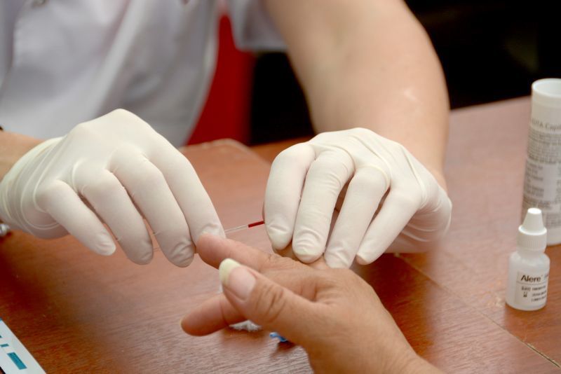 Las farmacias de CyL realizan más de 9.800 pruebas de detección de VIH/SIDA