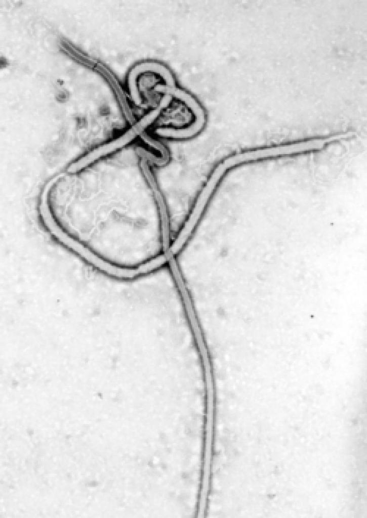 Virus del Ébola