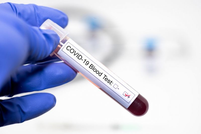 El coronavirus se desata en Castilla y León: 10 fallecidos, 1.081 nuevos casos, 382 brotes y 3.107 vinculados